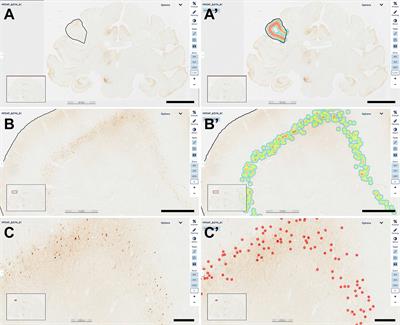 Development and characterization of a non-human primate model of disseminated synucleinopathy